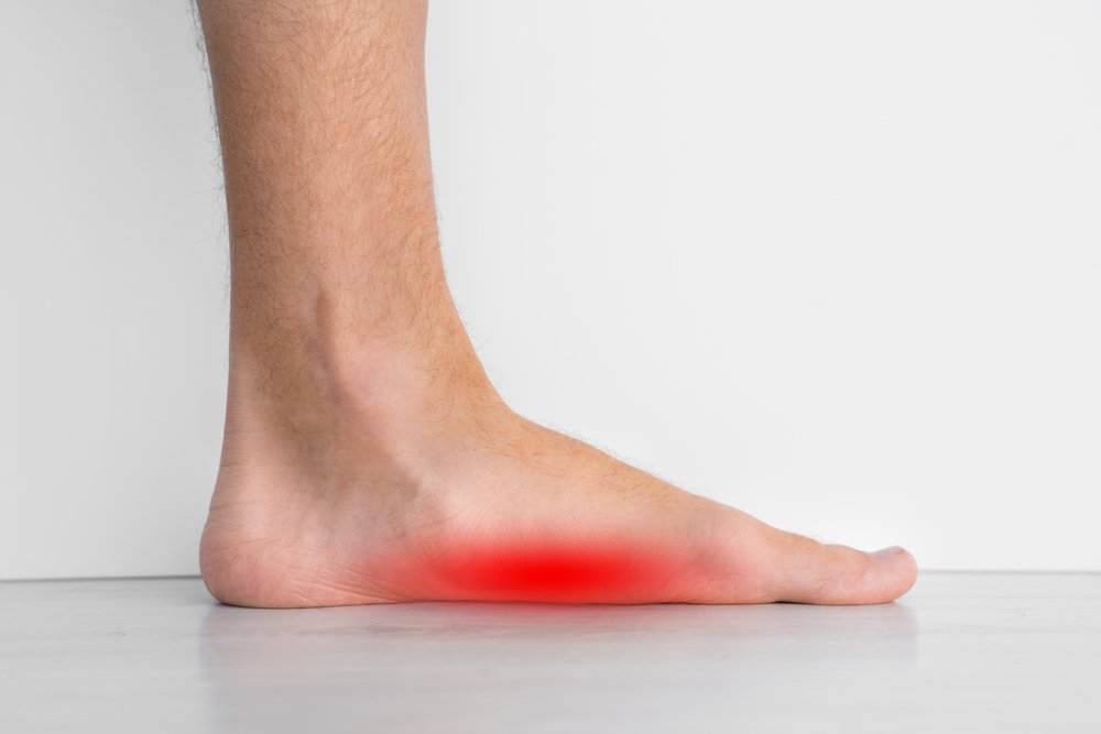 How to Fix Overpronated Ankles Custom Orthotics Blog Upstep